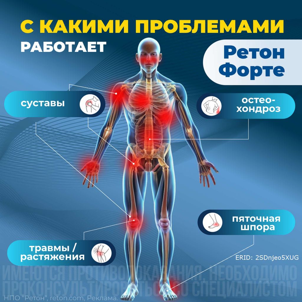 Ретон Форте аппарат терапевтический комплексный, 1 шт.